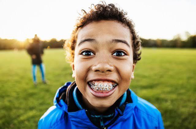 a-parent-s-guide-to-dental-braces-for-kids-when-and-where-to-start-4akid